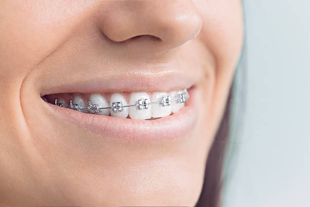 Best Traditional Braces  in Shady Hills, FL